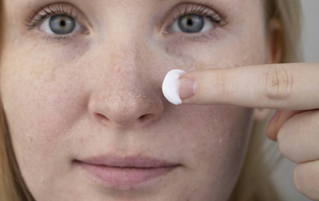 Traitement du psoriasis